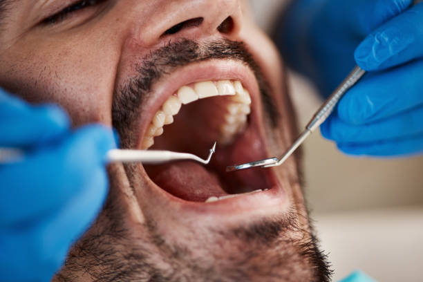 Best Emergency Dental Care for Abscessed Tooth in Randleman, NC