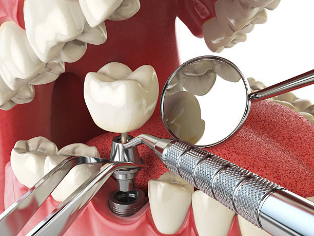 Best Pediatric Emergency Dentist in Randleman, NC
