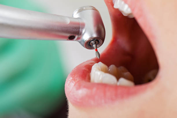 Best Emergency Dental Services for Seniors in Randleman, NC